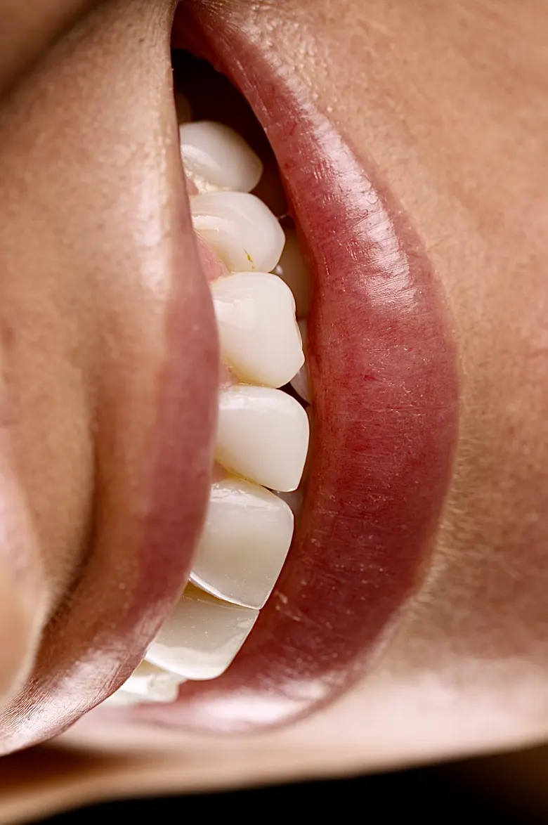 Macrofotografia de um sorriso: lábios entreabertos e detalhe da textura dos dentes