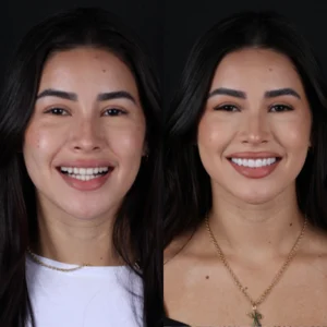 antes-e-depoispablowinckler